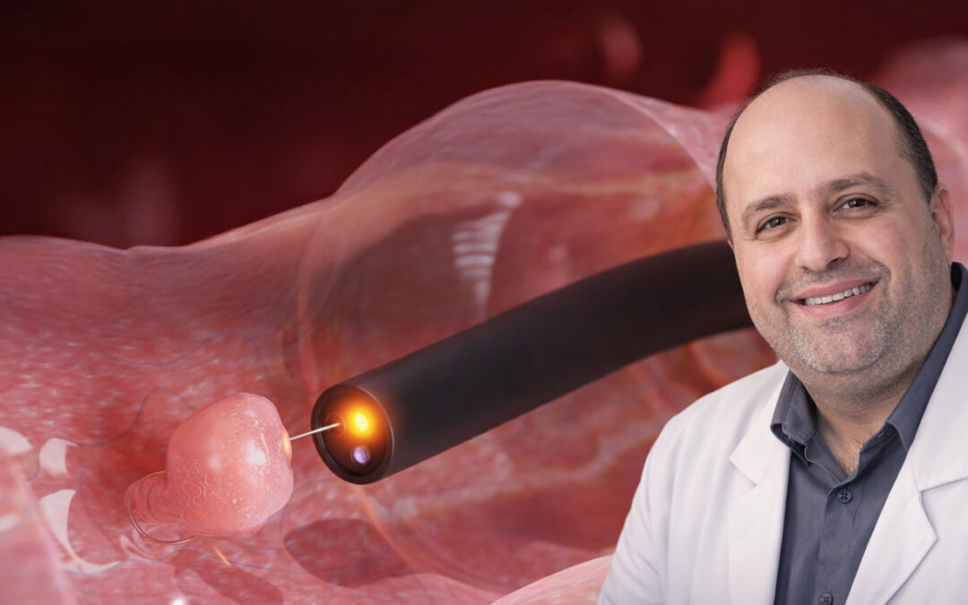 Colonoscopia: para que serve, como é feita e por que é essencial na prevenção do câncer de intestino